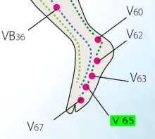 V65